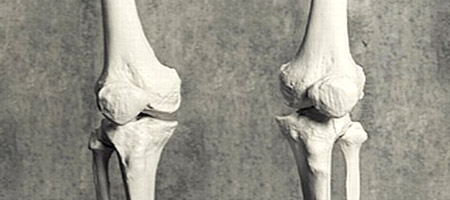 Skeleton Knees